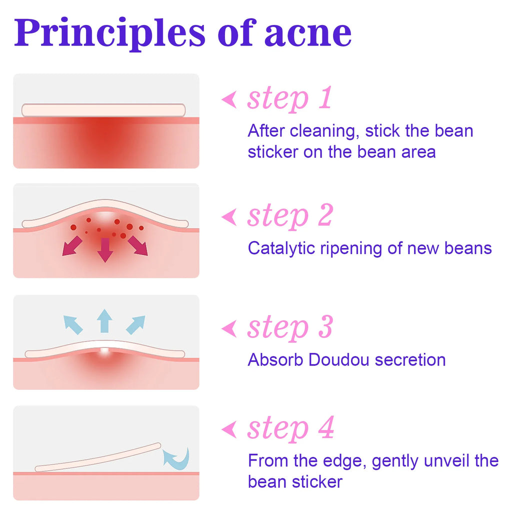 Acne Pimple Patches