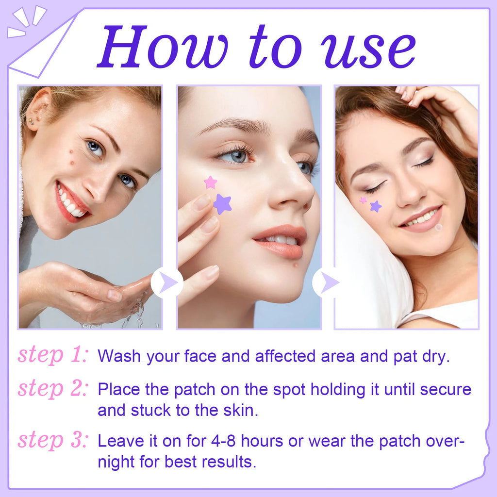 Acne Pimple Patches